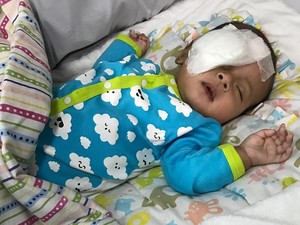 Selain Infeksi Saat Kehamilan, Katarak Seperti Bayi Asri Welas Bisa Disebabkan Hal Ini