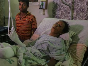 Duh! Banyak Warga Muslim Rohingya Cacat Akibat Ranjau Darat