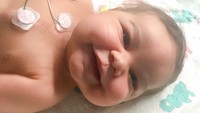 Transplantasi jantung tak hanya dilakukan pada orang dewasa. Transplantasi jantung juga membuat bayi ini bisa meniti masa depannya. (Foto: Instagram/warriorlincoln)