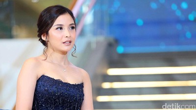 Harimu Tak Semulus Chelsea Olivia? Lihat Foto Ini Dulu Yuk!