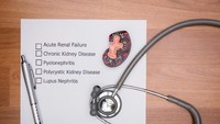 Lupus Nephritis adalah sebutan bagi penyakit lupus yang menyerang ginjal. Penyakit ini menyebabkan ginjal mengalami bengkak atau luka, yang bisa berakibat pada gagal ginjal. Foto: Ilustrasi/thinkstock