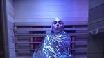 Lady Gaga Batalkan Konser Karena Penyakit Saraf Fibromyalgia