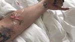 Lady Gaga Batalkan Konser Karena Penyakit Saraf Fibromyalgia
