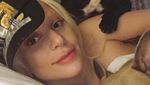 Lady Gaga Batalkan Konser Karena Penyakit Saraf Fibromyalgia