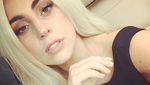 Lady Gaga Batalkan Konser Karena Penyakit Saraf Fibromyalgia