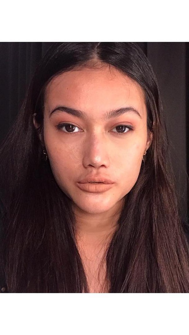 Lama tak terdengar kabarnya, Ratu Felisha kini ramai diperbincangkan media sosial karena perubahan bentuk bibirnya. Bibir Ratu Felisha kini lebih tebal. Netizen pun mengatakan bibirnya jontor. Perubahan bibirnya itu pun dipertanyakan. Diduga Ratu Felisha melakukan filler bibir. Benarkah? Foto: dok. Instagram