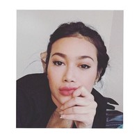 Dalam beberapa fotonya, bibir Ratu Felisha tampak terekspos lebih tebal, Terutama pada bibir bagian bawahnya. Foto: dok. Instagram