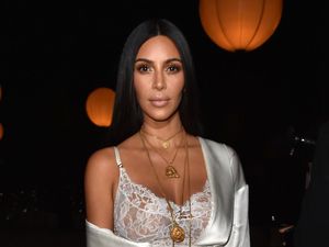 Kulit Merah dan Bersisik, Ini Cara Kim Kardashian Mengobatinya