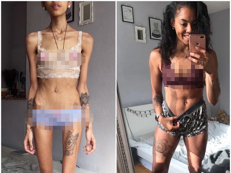 Foto Transformasi Luar Biasa Mantan Pengidap Gangguan Kecemasan