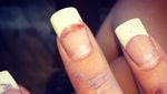 Bikin Ngilu! Potret Kuku yang Rusak karena Pakai Kuku Palsu Sembarangan