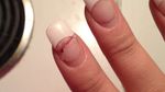 Bikin Ngilu! Potret Kuku yang Rusak karena Pakai Kuku Palsu Sembarangan