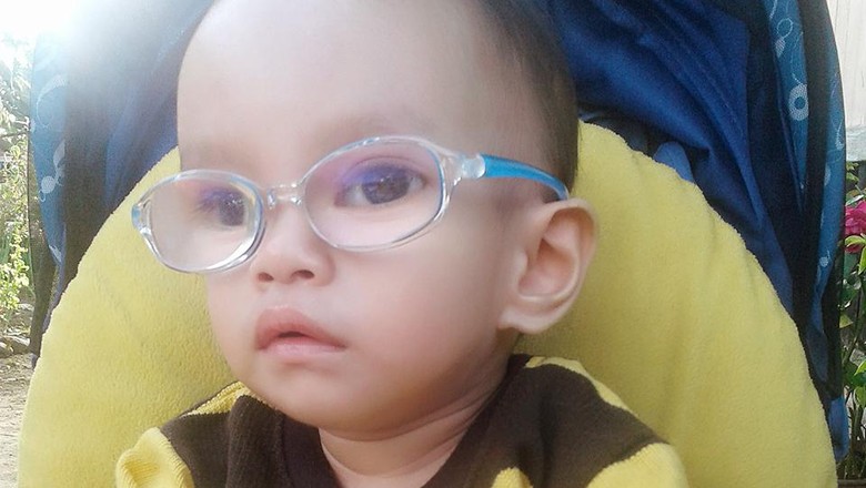 Abyn kena katarak sejak bayi/ Foto: dok Pribadi Abyn kena katarak sejak bayi/ Foto: dok Pribadi