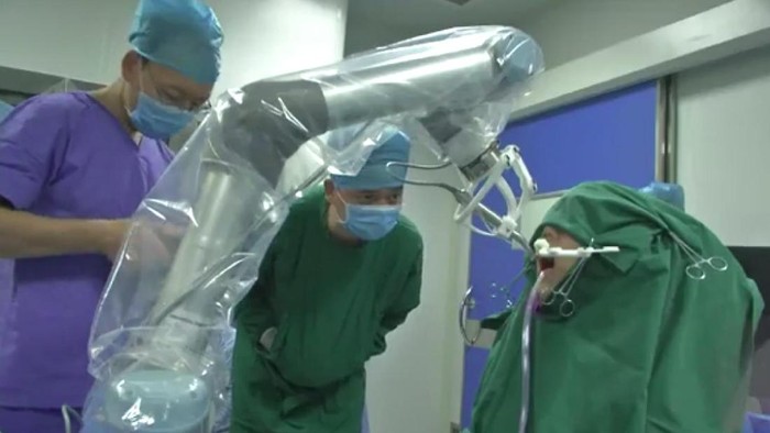 Keren! Robot Dokter Gigi Sukses Pasang Implan Gigi di Cina