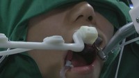 Operasi pemasangan implan memakan waktu satu jam, dan dilakukan sepenuhnya oleh robot tanpa bantuan dokter gigi. (Foto: SCMP)