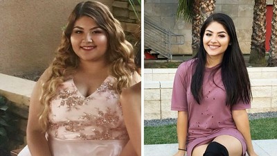 Potret Transformasi Ekstrem Para Wanita Cantik yang Sukses Kuruskan Badan