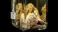 Beragam koleksi bagian tubuh manusia seperti tengkorak, wajah dalam awetan, usus, dan lain-lain (Mutter Museum of The College of Physicians of Philadelphia/ Facebook)