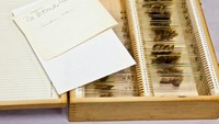 Mutter Museum sendiri mendapat irisan otak Einstein dari seorang dokter dan profesor dari Universitas Pennsylvania. Ada beberapa irisan yag dipajang di museum. Setiap irisan diapit dengan lapisan kaca, kemudian diletakkan di kotak terbuka (Mutter Museum of The College of Physicians of Philadelphia/ Facebook)