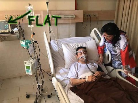 Heboh EKG Setya Novanto Grafiknya '<I>Flat</I>', Artinya Apa Sih?