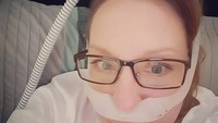 Bentuk sungkup CPAP yang digunakan wanita ini bentuknya sedikit lebih sederhana dan terlihat lebih mudah dipakai. (Foto: Instagram/notionsandnotoriety) 