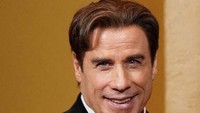 John Travolta pun memiliki kondisi serupa. Foto: ist.