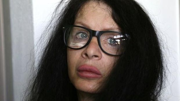 Ngeri! Aktris Jerman Suntikkan Bakteri ke Tubuh Sendiri Demi Awet Muda