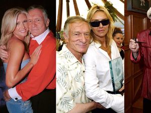 Meninggal karena Sebab Alami, Bos Playboy Hugh Hefner Pernah Sakit Serius