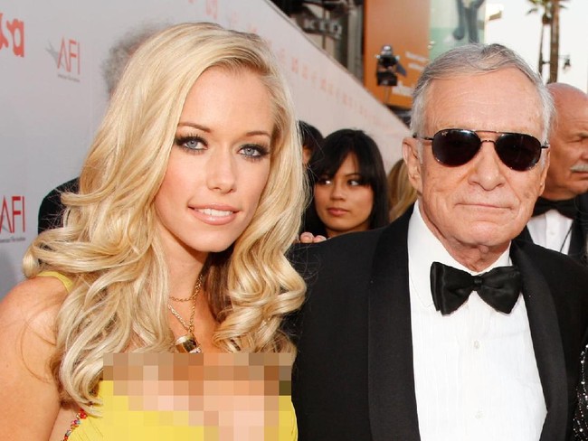 Kendra tak pernah menyangka bahwa hidupnya akan berakhir dengan pria berusia 78 tahun. Dia pun sudah berpikir bahwa cepat atau lambat akan segera mengakhiri hubungannya dengan Hugh. Hugh Hefner meninggal pada September 2017 di usia 91. Foto: dok. Getty Images