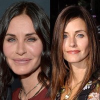 Courteney Cox mengakui pernah memakai botox agar tampak lebih muda dari usianya. Aktris 51 tahun itu diduga juga melakukan facelift sehingga penampilannya kini tampak semakin segar untuk mengimbangi dengan kekasihnya Johnny McDaid yang berusia 38 tahun. Foto: Dok. Getty Images