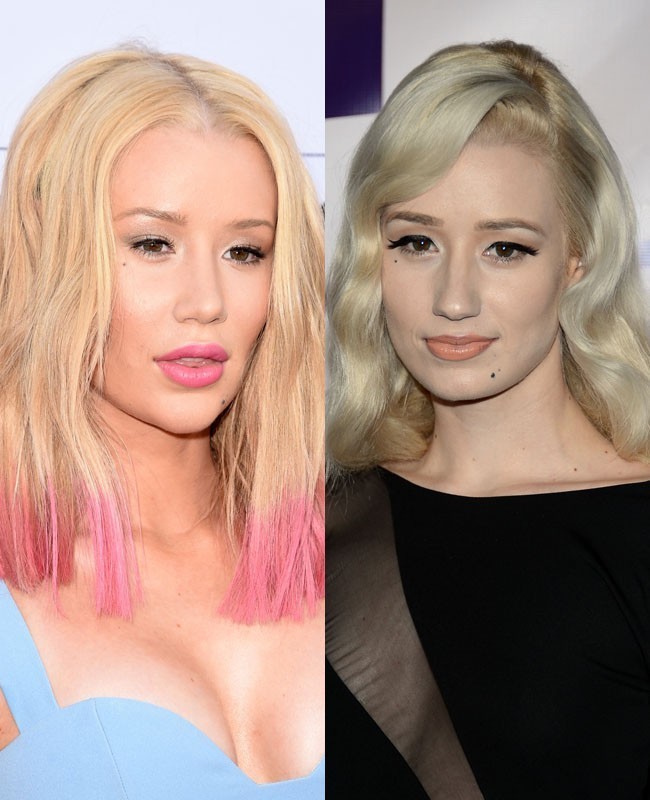 Tidak ingin menyembunyikan penampilan barunya, rapper Iggy Azalea mengakui bahwa ia melakukan operasi payudara. Aku mengubah sesuatu, empat bulan lalu, aku mendapat payudara lebih besar, ujar penyanyi Fancy itu pada Vogue Amerika edisi April. Perasaan tidak percaya diri Iggy sangat besar sebelum melakukan bedah plastik, kini ia lebih bangga dengan dada yang lebih seksi. Sulit menjadi wanita di 2015 ini dengan hadirnya media sosial. Banyak tekanan untuk menjadi cantik, kata wanita 25 tahun itu. Foto: Dok. Getty Images