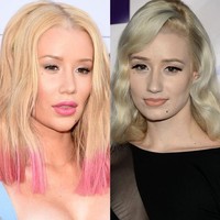 Tidak ingin menyembunyikan penampilan barunya, rapper Iggy Azalea mengakui bahwa ia melakukan operasi payudara. Aku mengubah sesuatu, empat bulan lalu, aku mendapat payudara lebih besar, ujar penyanyi Fancy itu pada Vogue Amerika edisi April. Perasaan tidak percaya diri Iggy sangat besar sebelum melakukan bedah plastik, kini ia lebih bangga dengan dada yang lebih seksi. Sulit menjadi wanita di 2015 ini dengan hadirnya media sosial. Banyak tekanan untuk menjadi cantik, kata wanita 25 tahun itu. Foto: Dok. Getty Images