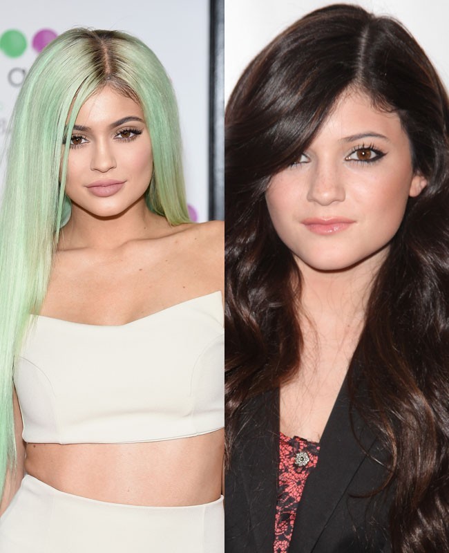 Kylie Jenner merasa insecure dengan penampilan bibirnya yang tipis. Hal itulah yang diungkapkan oleh adik tiri Kim Kardashian itu ketika memberikan alasan melakukan suntik filler pada bibirnya agar menjadi lebih seksi dan bervolume. Meski sempat membantah melakukan prosedur filler, namun akhirnya Kylie berkata jujur di tayangan Keeping Up with The Kardashians’. Foto: Dok. Getty Images