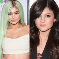 Kylie Jenner merasa insecure dengan penampilan bibirnya yang tipis. Hal itulah yang diungkapkan oleh adik tiri Kim Kardashian itu ketika memberikan alasan melakukan suntik filler pada bibirnya agar menjadi lebih seksi dan bervolume. Meski sempat membantah melakukan prosedur filler, namun akhirnya Kylie berkata jujur di tayangan Keeping Up with The Kardashians’. Foto: Dok. Getty Images