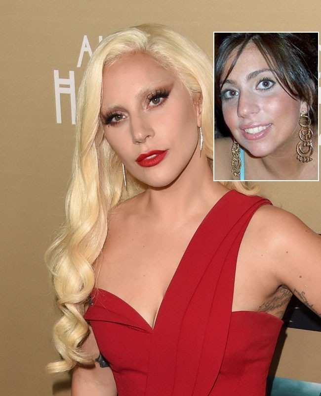 Lady Gaga disebut-sebut melakukan operasi pemancungan hidung atau rhinoplasty. Memang hidung si pelantun Applause itu kini lebih mancung dibanding dulu. Foto: Dok. Getty Images