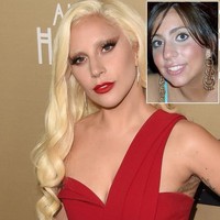 Lady Gaga disebut-sebut melakukan operasi pemancungan hidung atau rhinoplasty. Memang hidung si pelantun Applause itu kini lebih mancung dibanding dulu. Foto: Dok. Getty Images