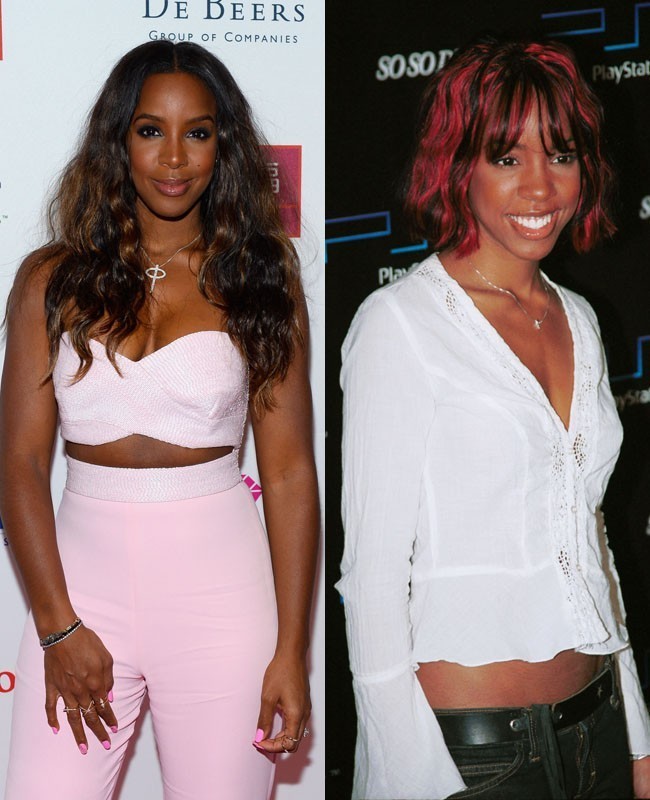 Di awal kemuculannya, Kelly Rowland memiliki dada yang kecil. Namun, sekarang payudara Kelly jauh lebih berisi. Tentunya, perubahan payudara penyanyi R&B itu bukan karena sebuah keajaiban. Penyanyi Kelly Rowland juga secara terang-terangan mengaku bahwa ia memasang implan pada 2008. Mantan personel girl band Destinys Child itu menjelaskan setelah melakukan pembesaran payudara, ia merasa lebih percaya diri dan mempermudahnya dalam mendapatkan busana. Foto: Dok. Getty Images