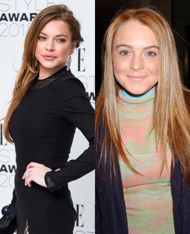 Aktris Lindsay Lohan melakukan operasi plastik agar wajahnya menjadi lebih tirus. Dia juga mencoba filler, prosedur kecatikan tanpa operasi yang bisa diterapkan untuk area bibir, hidung, bawah mata dan pipi. Foto: Dok. Getty Images