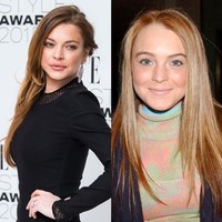 Aktris Lindsay Lohan melakukan operasi plastik agar wajahnya menjadi lebih tirus. Dia juga mencoba filler, prosedur kecatikan tanpa operasi yang bisa diterapkan untuk area bibir, hidung, bawah mata dan pipi. Foto: Dok. Getty Images