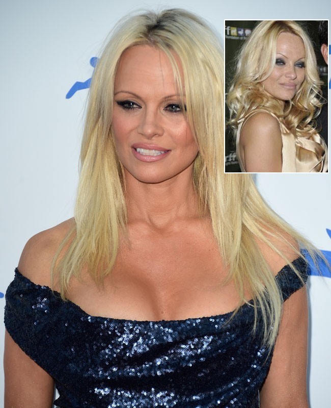 Payudara besar tidak begitu saja dianugerahi kepada Pamella Anderson. Bintang serial TV Baywatch itu mendapatkannya dari implan payudara. Jelas terlihat pada saat baru memulai karier, asetnya itu masih dalam ukurang yang normal. Foto: Dok. Getty Images