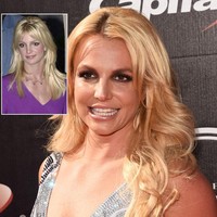 Dalam wawancara dengan In Style, Britney Spears, mengakui bibirnya sudah tidak asli lagi. Aku dulu pernah suntik bibir, katanya. Suntik bibir itu dilakukannya pada seorang dokter bedah plastik terkenal di Beverly Hills, Dr. Raj Kanodia. Selain bibir, Britney juga mengoperasi kelopak matanya untuk menghilangkan lemak dan  menjalani prosedur kecantikan pengangkatan alis. Foto: Dok. Getty Images
