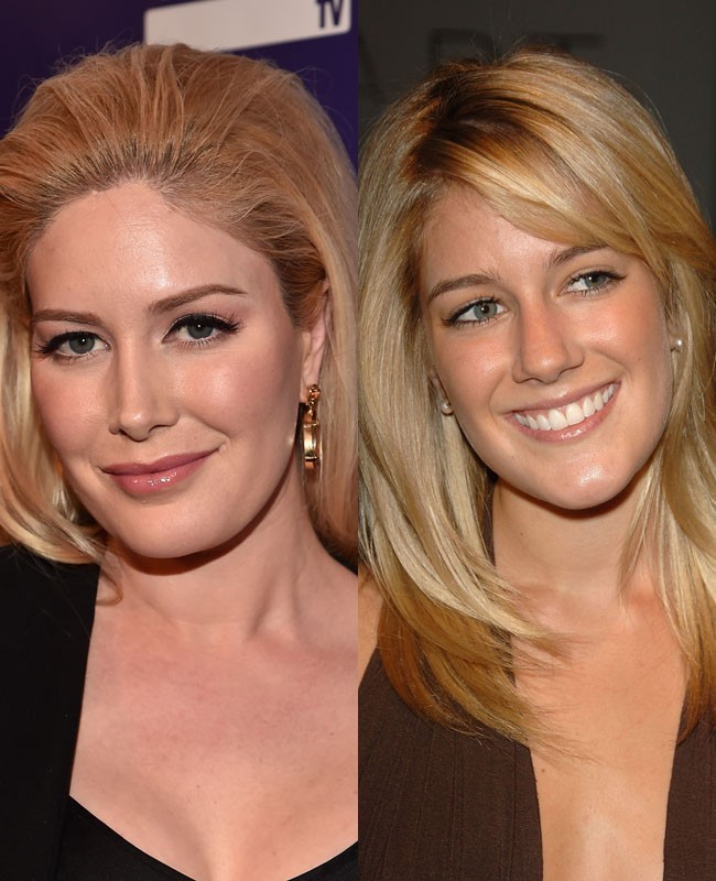 Heidi Montag merupakan salah satu selebriti Hollywood yang dikenal pernah melakukan sepuluh operasi plastik dalam waktu satu hari. Namun ia membantahnya dan mengaku tidak pernah melakukan operasi tersebut. Berdasarkan foto yang diambil pada 2006 dan 2010, wajah pemain film serial How I Met Your Mother itu mengalami perubahan pada bagian mata, hidung, dan bentuk wajah. Bibirnya juga terlihat lebih tebal dari sebelumnya. Foto: Dok. Getty Images