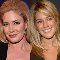 Heidi Montag merupakan salah satu selebriti Hollywood yang dikenal pernah melakukan sepuluh operasi plastik dalam waktu satu hari. Namun ia membantahnya dan mengaku tidak pernah melakukan operasi tersebut. Berdasarkan foto yang diambil pada 2006 dan 2010, wajah pemain film serial How I Met Your Mother itu mengalami perubahan pada bagian mata, hidung, dan bentuk wajah. Bibirnya juga terlihat lebih tebal dari sebelumnya. Foto: Dok. Getty Images