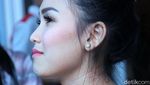 Tanda Merah di Leher Ayu Ting Ting, Bekas Kerokan?