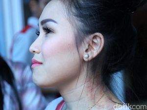 Bekas Kerokan Ayu Ting Ting, Celana Skinny Jeans dan Bahayanya