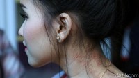 Cepet sembuh ya Ayu!