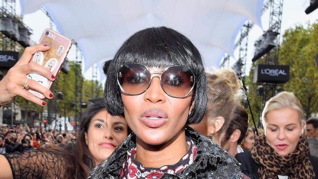 Naomi Campbell juga memiliki rahang pipi tinggi yang membuat wajahnya semakin menawan. Tulang pipi itu tentu telah membantunya mempertahankan karier selama 30 tahun.Foto: Getty Images