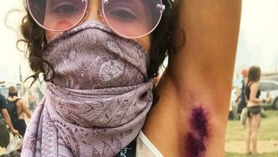 Tren Mewarnai Ketiak di Instagram, Keren atau Aneh?