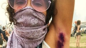 Tren Mewarnai Ketiak di Instagram, Keren atau Aneh?