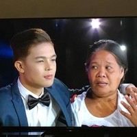 Berubah 180 derajat, wajah Xander jauh dari aslinya. Bahkan ibunya sendiri hampir tak mengenalinya. Xander diketahui melalui beberapa prosedur operasi plastik yang mencakup bagian hidung, dagu, alis, bulu mata, gigi, dan bibir.  (Foto: ist.)