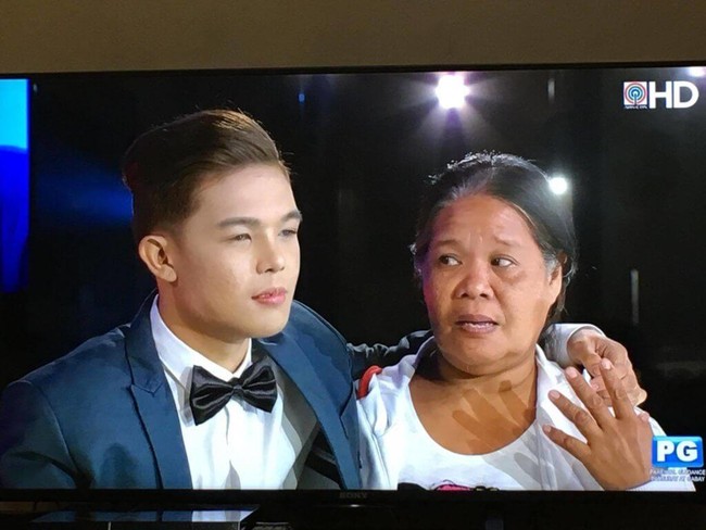 Berubah 180 derajat, wajah Xander jauh dari aslinya. Bahkan ibunya sendiri hampir tak mengenalinya. Xander diketahui melalui beberapa prosedur operasi plastik yang mencakup bagian hidung, dagu, alis, bulu mata, gigi, dan bibir.  (Foto: ist.)