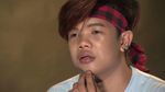 Bosan Dibully Soal Fisiknya, Artis Ini Nekat Operasi Plastik Wajahnya